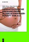 Dermatologische Erkrankungen in Der Schwangerschaft Von A-Z - Volker Briese