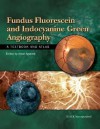 Fundus Fluorescein and Indocyanine Green Angiography: A Textbook and Atlas - Amar Agarwal