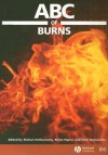 ABC of Burns - Shehan Hettiaratchy, Shehan Hettiaratchy