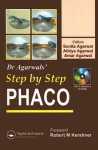 Step by Step Phaco [With 2 Interactive CDROMs] - Sunita Agarwal