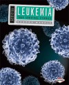 Leukemia: True Survival Stories - Sandra Markle