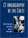 CT Angiography of the Chest - Martine Remy-Jardin, Jacques Remy, John R. Mayo, Nestor L. Müller