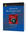 Advanced Reconstruction - Hip - Jay R. Lieberman, Daniel J. Berry