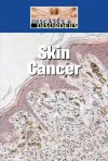 Skin Cancer - Bonnie Juettner