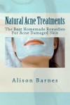 Natural Acne Treatments: The Best Homemade Remedies For Acne Damaged Skin - Alison Barnes