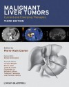 Malignant Liver Tumors - Pierre-Alain Clavien, Kim Lyerly