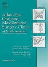 Distraction Osteogenesis for Maxillofacial Surgeons - Richard H. Haug, Joseph Van Sickels, Bethany Serafin