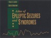 Atlas of Epileptic Seizures and Syndromes, Text & CD-ROM - Hans O. Luders, Soheyl Noachtar