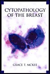 Cytopathology of the Breast with Imaging and Histologic Correlation - Grace T. McKee