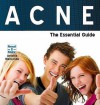 Acne The Essential Guide (Need2know) - Antonia Mariconda