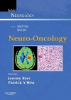 Neuro-Oncology: Blue Books of Neurology Series - Jeremy Rees, Patrick Yung Chih Wen