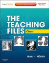The Teaching Files: Chest: Expert Consult - Online and Print - Nestor L. Müller, C. Isabela S. Silva