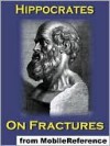 On Fractures - Hippocrates, Francis Adams