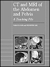 CT and MRI of the Abdomen and Pelvis: A Teaching File - Pablo R. Ros, Sylvester Lee