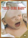 The First Test-Tube Baby (Days That Changed The World) - Fiona MacDonald