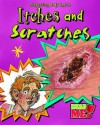 Itches and Scratches - Angela Royston