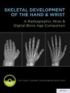 Skeletal Development of the Hand and Wrist: A Radiographic Atlas and Digital Bone Age Companion - Cree M. Gaskin, S. Lowell Kahn, J. Christoper Bertozzi, Paul M. Bunch