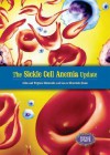 The Sickle Cell Anemia Update - Alvin Silverstein, Virginia B. Silverstein, Laura Silverstein Nunn