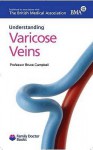 Varicose Veins - Bruce Campbell