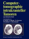 Computer Und Kernspin Tomographie Intrakranieller Tumoren Aus Klinischer Sicht - Ekkehard Kazner, Sigurd Wende, Thomas Grumme, Roland Felix