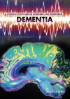 Dementia - Therese Shea