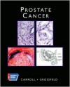 Prostate Cancer - Peter R. Carroll