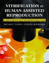 Vitrification in Assisted Reproduction: A User's Manual and Trouble-Shooting Guide - Michael J. Tucker, Michael J. Tucker