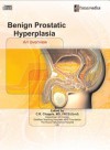 Benign Prostatic Hyperplasia (BPH): An Overview (Urology) - C.R. Chapple