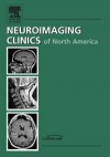 Intracranial Aneurysms, an Issue of Neuroimaging Clinics - David Biondi, Mauricio Castillo, Suresh K. Mukherji