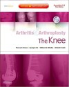 Arthritis and Arthroplasty: the Knee - Thomas E. Brown, William M. Mihalko, Quanjun Cui, Khaled Saleh