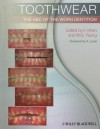 Toothwear: The ABC of the Worn Dentition - Farid Khan, William George Young, A. Lussi