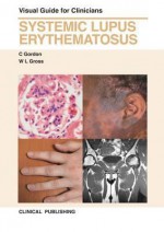 Systemic Lupus Erythematosus - Caroline Gordon, Gross L. Wolfgang