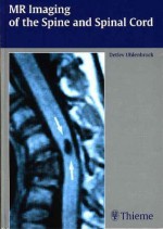 MR Imaging of the Spine and Spinal Cord - Detlev Uhlenbrock, Grahame Larkin