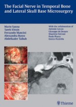 The Facial Nerve in Temporal Bone and Lateral Skull Base Microsurgery - Mario Sanna