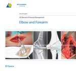 AO Manual of Fracture Management: Elbow & Forearm - Jesse B. Jupiter