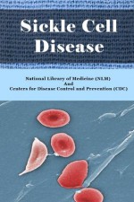 Sickle Cell Disease - Symptoms, Diagnosis, Treatment and Recent Developments of Sickle Cell Anemia - National Library of Medicine (NLM), Centers for Disease Control and Prevention (CDC), Huey Tsen