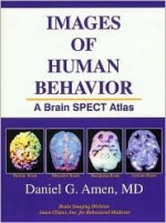 Images of Human Behavior: A Brain SPECT Atlas - Daniel G. Amen