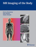 MR Imaging of the Body - Ernst J. Rummeny, Peter Reimer, Walter Heindel, T. Allkemper, M. Asmussen