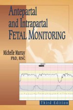 Antepartal and Intrapartal Fetal Monitoring - Michelle Murray