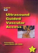 Ultrasound Guided Vascular Access (DVD) - James Mateer