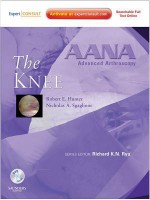 Aana Advanced Arthroscopy: The Knee - Robert E. Hunter, Nicholas A. Sgaglione, Richard K.N. Ryu