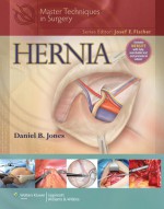 Master Techniques in Surgery: Hernia - Daniel B. Jones