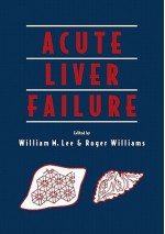 Acute Liver Failure - William M. Lee