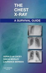 The Chest X-Ray: A Survival Guide - de Lacey, Gerald, Simon Morley, Laurence Berman