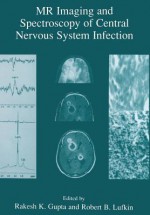 MR Imaging and Spectroscopy of Central Nervous System Infection - Rakesh K Gupta, Robert B Lufkin