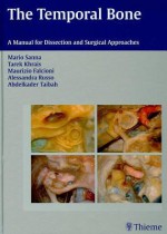 The Temporal Bone: A Manual for Dissection and Surgical Approaches - Mario Sanna, Mario Sanna, Tarek Khrais, Maurizio Falcioni, Alessandra Russo