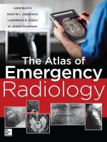 Atlas of Emergency Radiology - Jake Block, Martin Jordanov, Lawrence Stack, R Jason Thurman