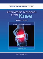 Arthroscopic Techniques of the Knee: A Visual Guide - Thomas Gill