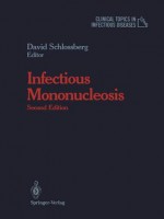 Infectious Mononucleosis - David Schlossberg