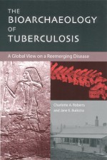 The Bioarchaeology of Tuberculosis: A Global View on a Reemerging Disease - Charlotte Roberts, Jane Buikstra